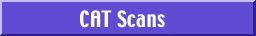 CAT Scans